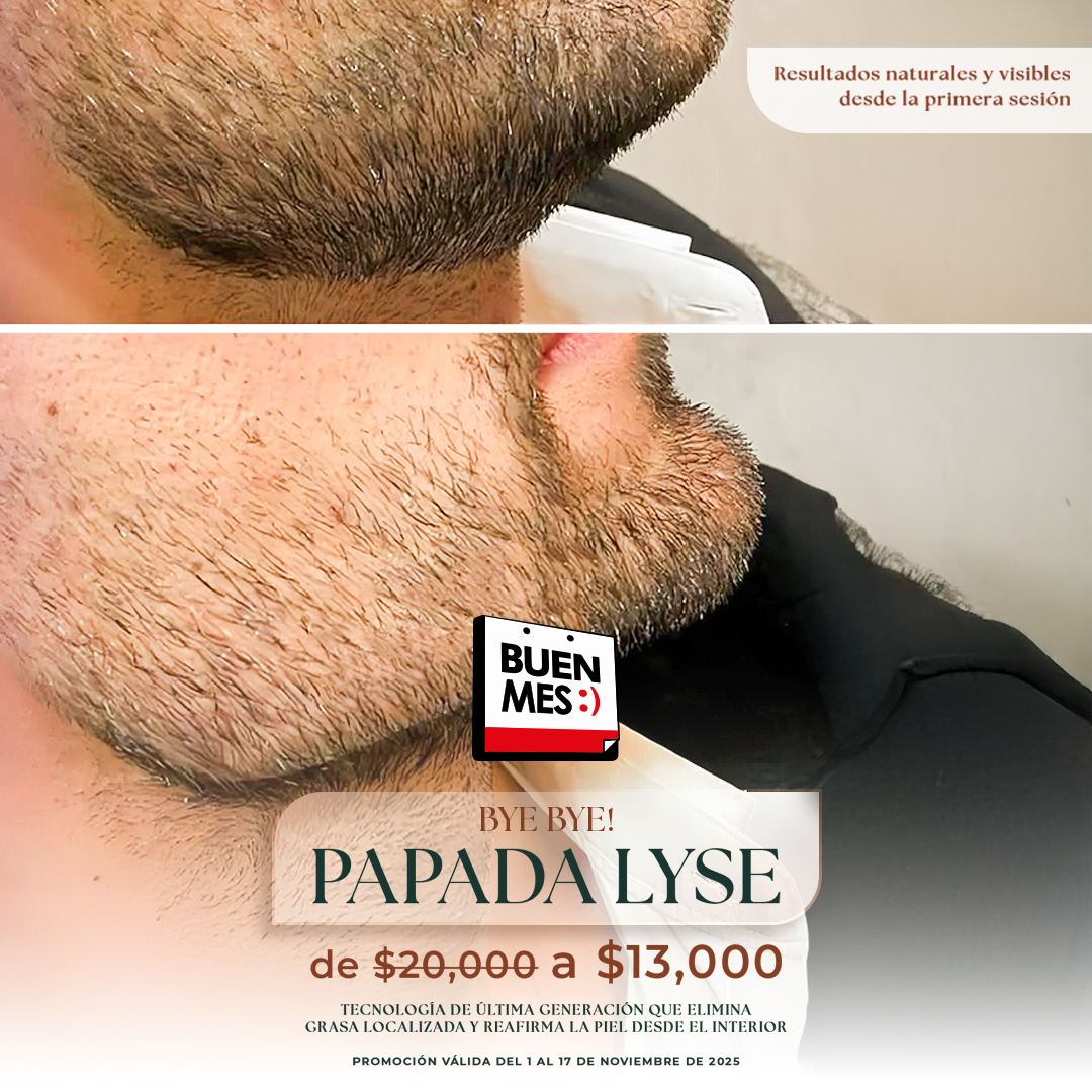 Copia de MUSE_PAPADA-LYSE