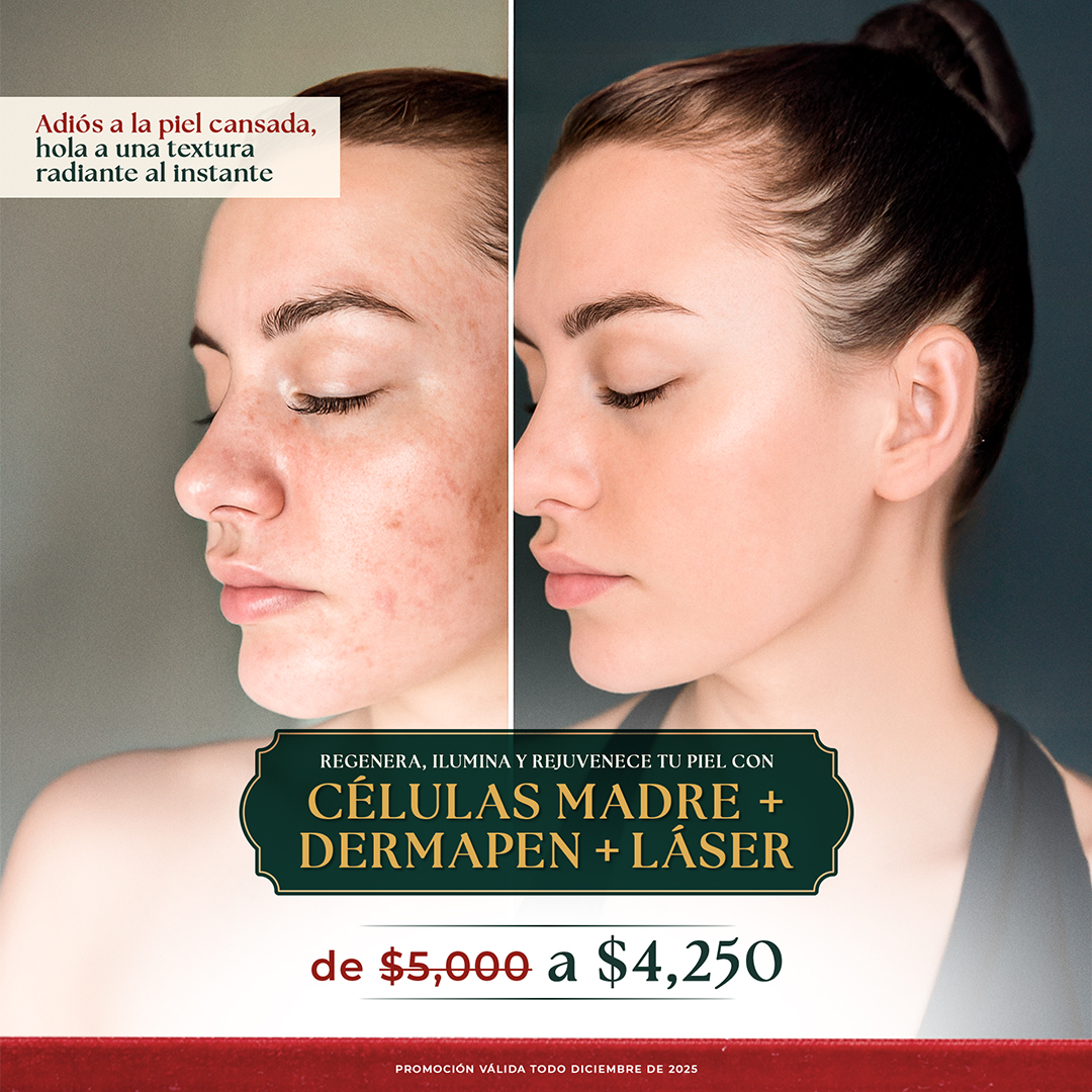 MUSE_CELULAS MADRE+DERMAPEN+LÁSER
