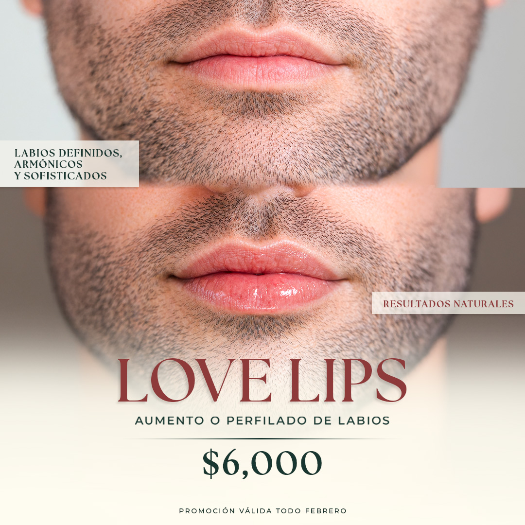 MUSE_DEPILACIÓN LÁSER